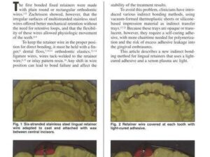 Lim SM, Hong RK, Park JY. A New Indirect Bonding Technique for Lingual Retainers. J Clin Orthod 2004;38:652-655.