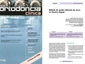 Tsuruta M, Hong RK, Echarri P. Indirect bending method of mushroom archwire. Ortodoncia Clinica 2006;9:18-20.