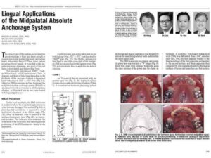 Hong RK, Lim SM, Heo JM, Baik SH. Lingual applications of the midpalatal absolute anchorage system. J Clin Orthod 2012;46:344-353.