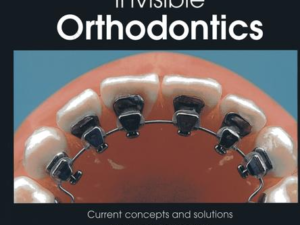 Invisible Orthodontics- Current concepts and solutions in lingual orthodontics
