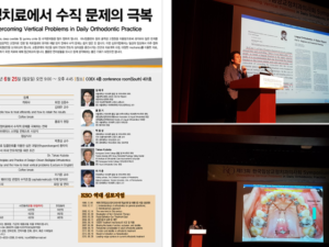 2017년 한국임상교정치과의사회 심포지엄에서 “설측교정에서 수직적 문제를 극복하는 전략”에 대해서 강연을 하였습니다.
